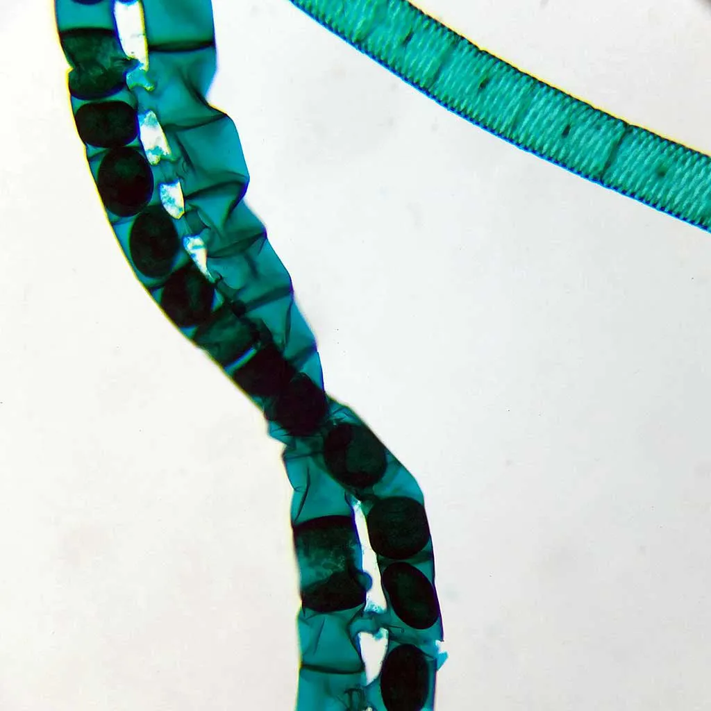 Spirogyra-conjugation-w.m.