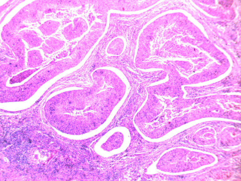 Pcs Basic Human Pathology Teaching Slides Pathology Histology