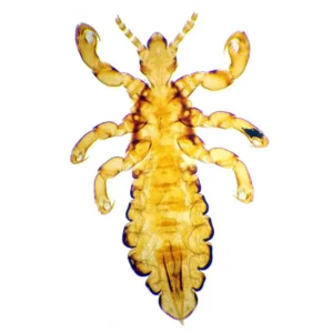 Head louse whole mount
