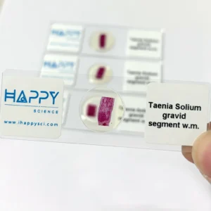 Taenia Solium gravid segment