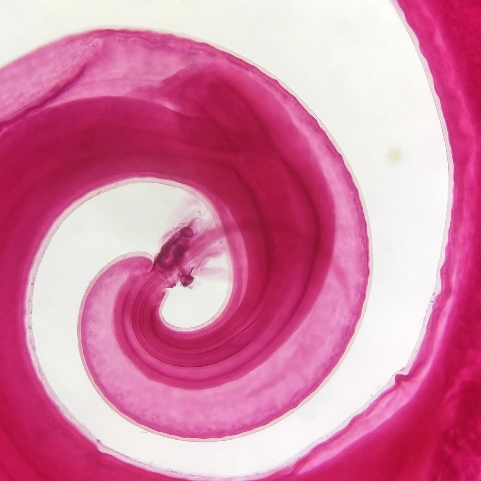 Trichuris trichiura male
