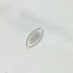 Trichuris trichiura ova whole mount