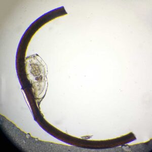 head louse egg w.m. attached on human hair
