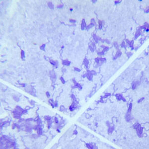 Bacterial uniflagellate, pyocyanin smear
