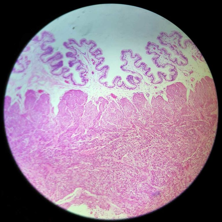 Cervix Histology Diagram