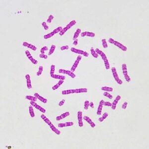 Human-chromosome