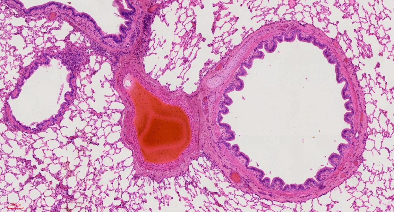 Human lung section histology slides, 7 µm sec., H&E Stain, human ...