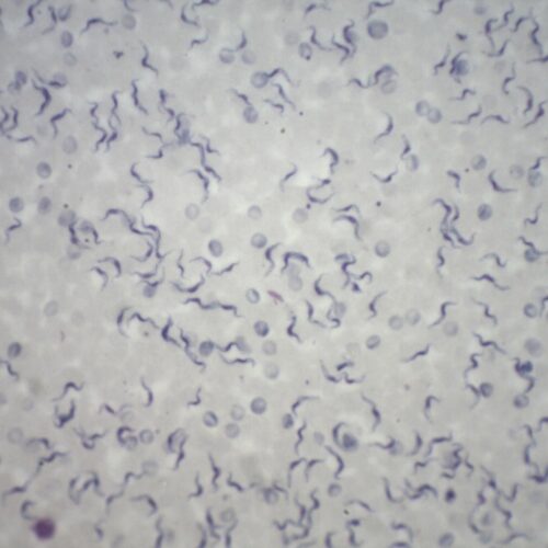 Trypanosome-blood-smear