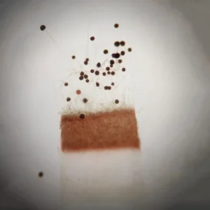 Aspergillus sp. whole mount prepared slides