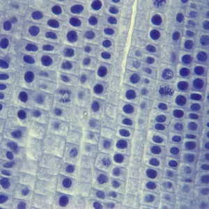 Typical plant mitosis prepared slides
