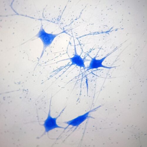 Motor nerve cells