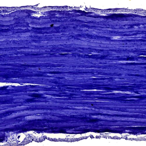 Skeletal muscle of Human l.s. (Hematoxylin Stain)
