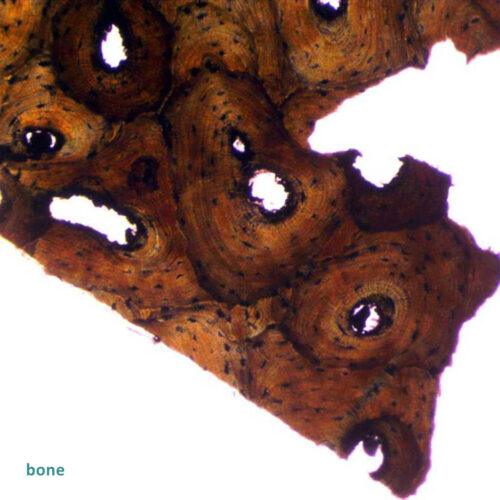Compact bone ground section
