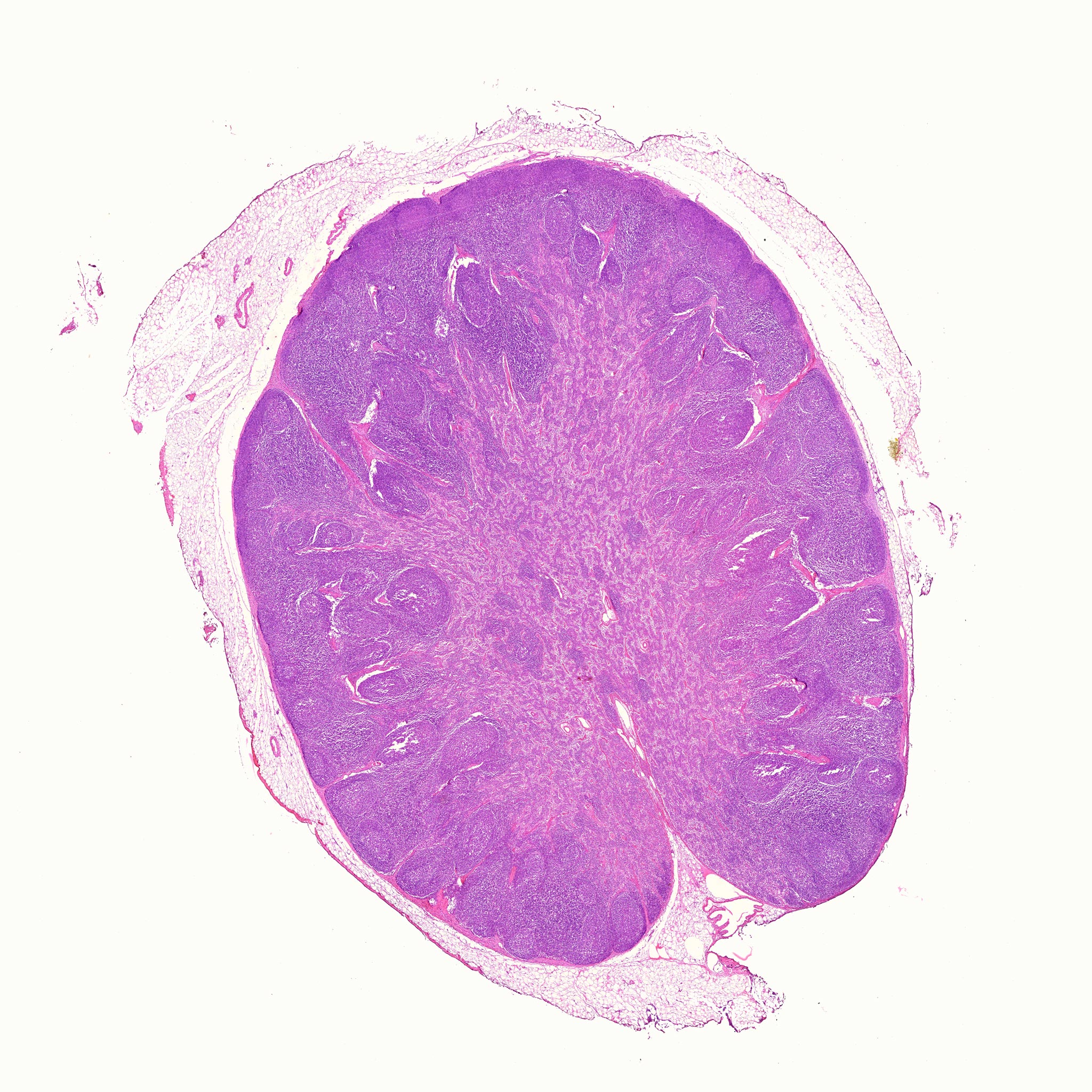 lymph node histology drawing