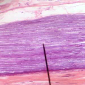 human muscle spindle section prepared slides