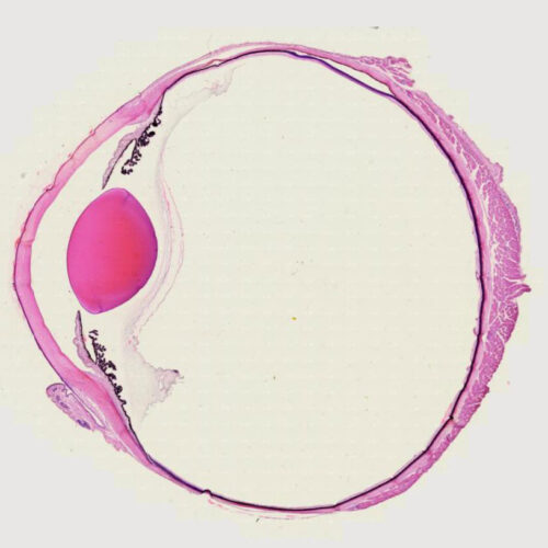 mammal eye section with the optic nerve