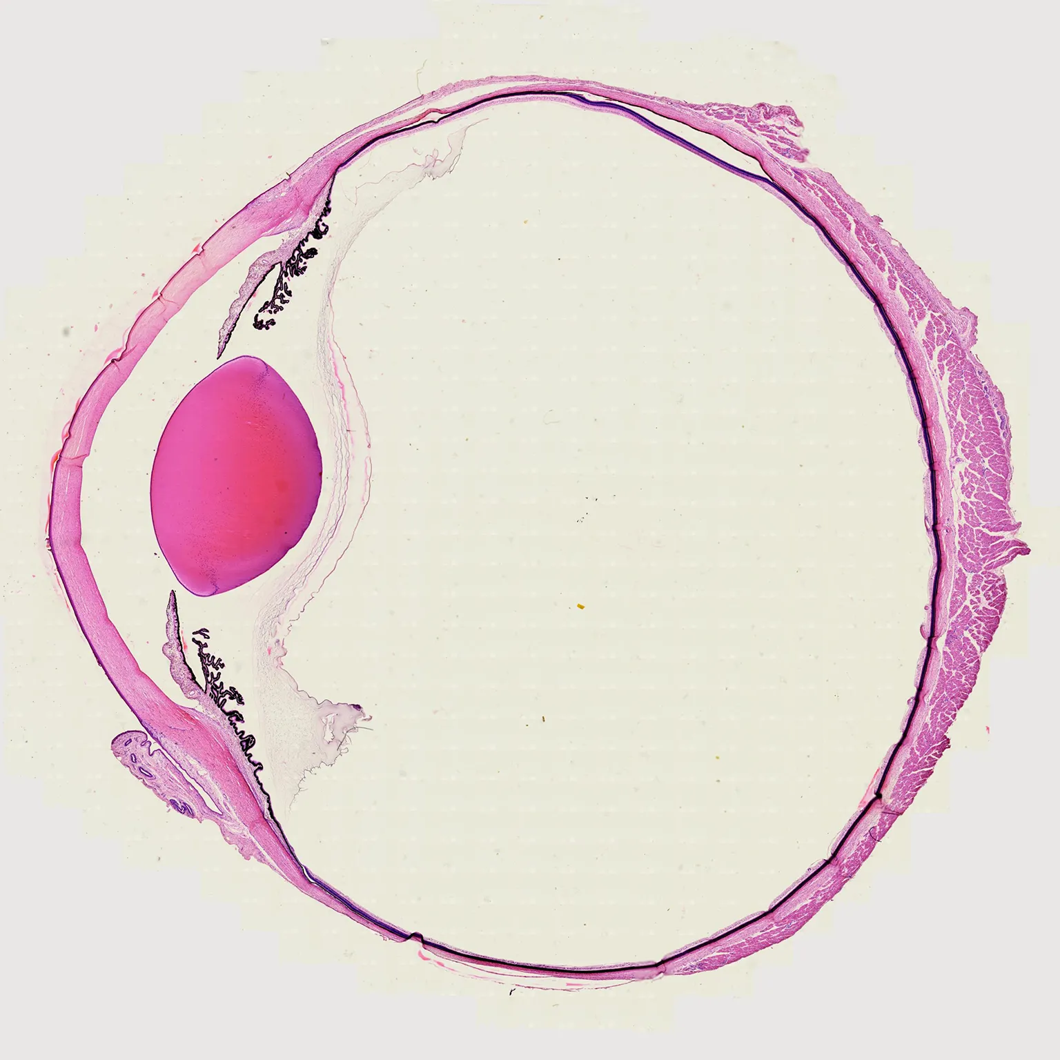 mammal eye section with the optic nerve