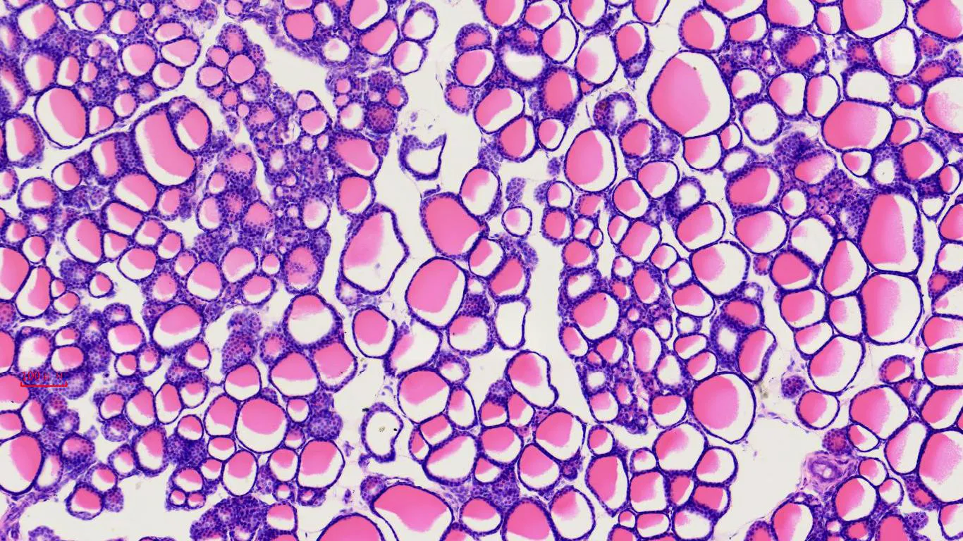 1pcs thyroid and parathyroid section prepared microscope slides, H.E. stain - Image 2
