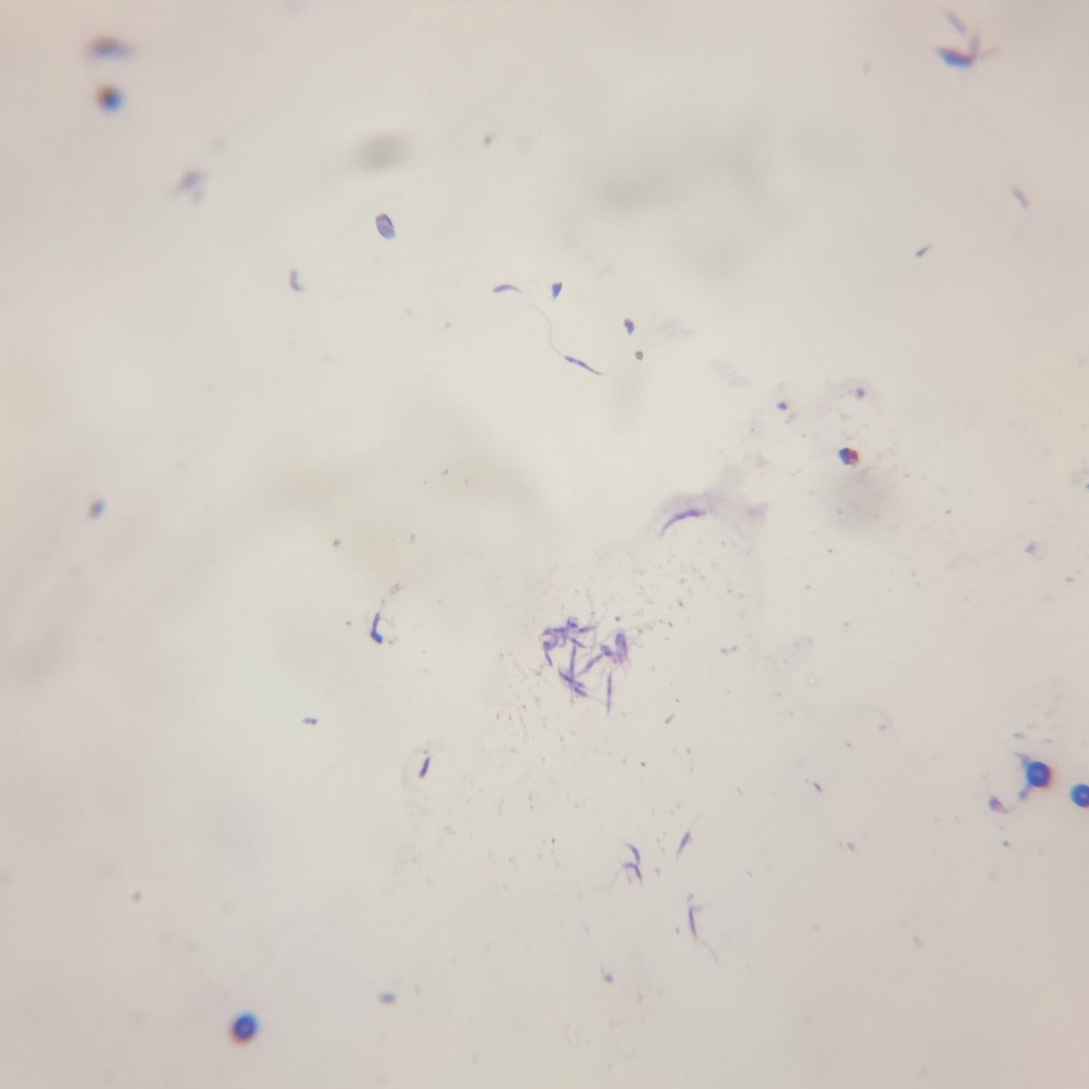 1 piece Leishmania donovani promastigotes, causes kala-azar, smear