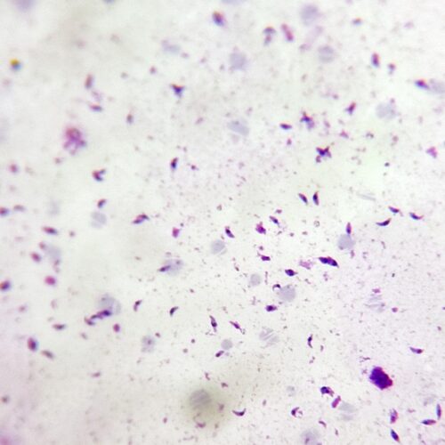 Toxoplasma gondii under microscope