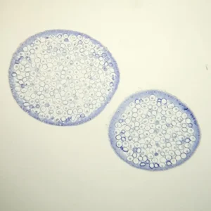 ascaris equorum uterus section show animal mitosis all stages
