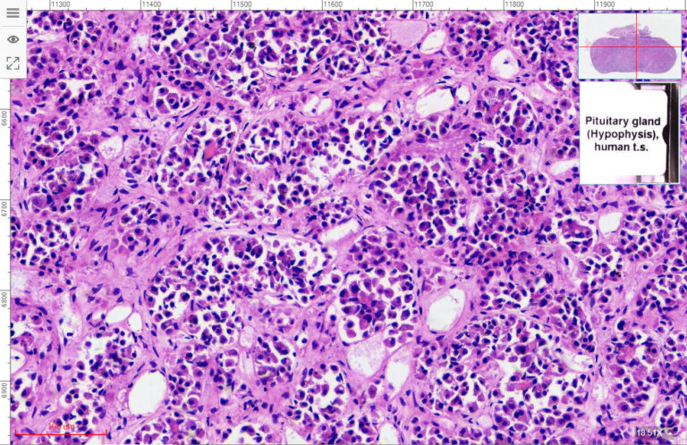 1pcs Human pituitary gland section H.E. stain