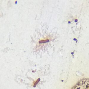 Salmonella typhi with flagella