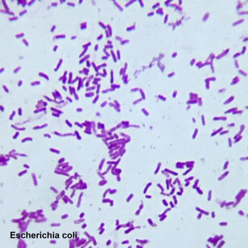 Escherichia coli smear