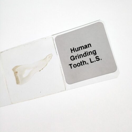 human grinding tooth l.s.