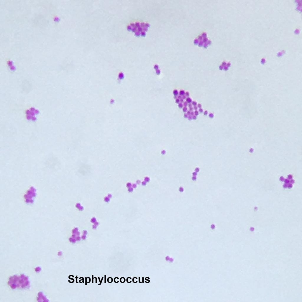 Eisco Prepared Microscope Slide - Staphylococcus Aureus Gram Positive  Microbiology