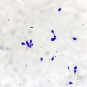 Giardia lamblia intestinalis, smear with trophozoites