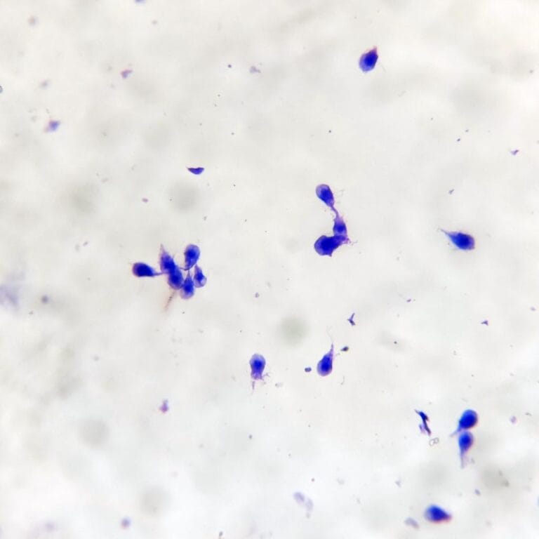 1 Piece Giardia Lamblia Intestinalis Smear With Trophozoites Human Parasite 7749