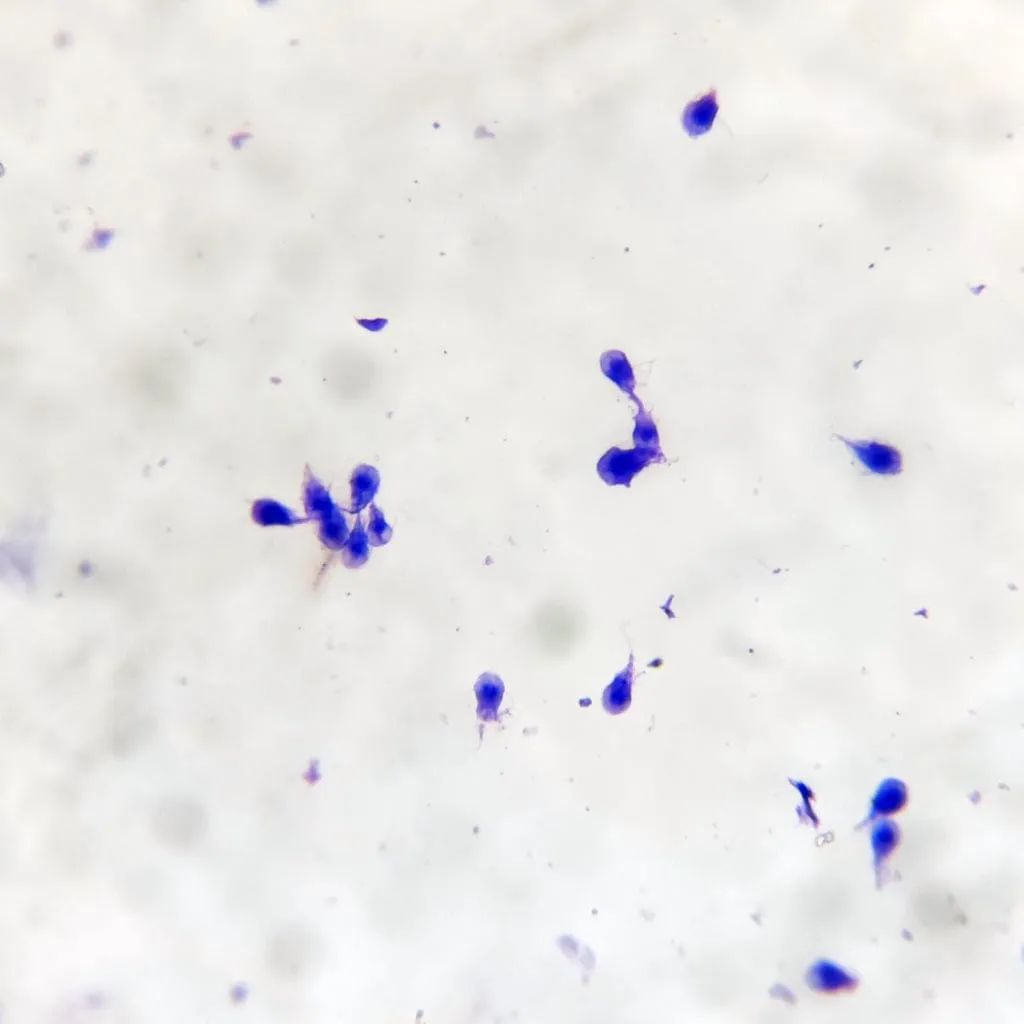 Giardia lamblia intestinalis, smear with trophozoites