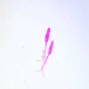 Schistosoma japonicum Miracidium w.m.
