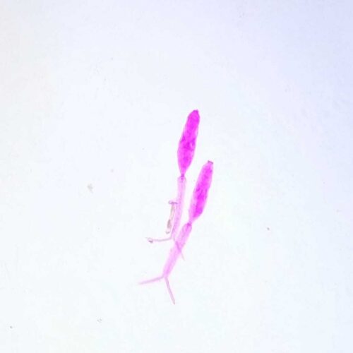 Schistosoma japonicum Miracidium w.m.