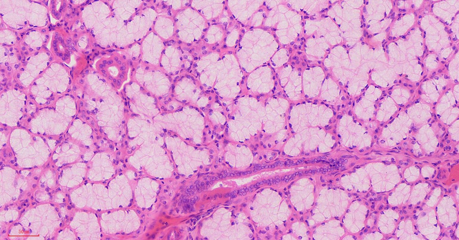 Histology Slides Database Human Parotid Glands Histology Slides | Sexiz Pix