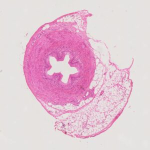 Human Ureter cross-section histology slides, 7 µm sec., H&E Stain, human histology slides wholesale supplier