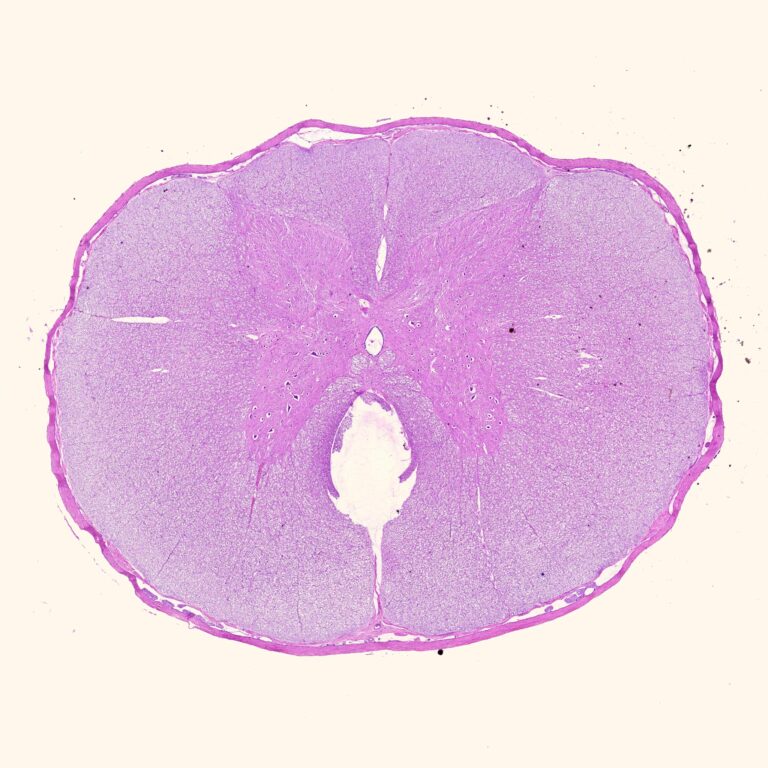 Human Spinal Cord Cross Section Histology Slides M Sec H E Stain