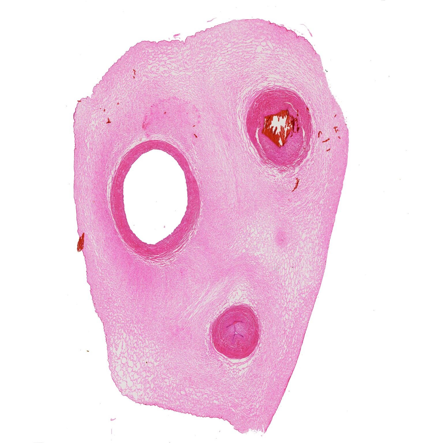 Mucous tissue, Umbilical cord of Fetus t.s., 7 µm sec., H&E Stain