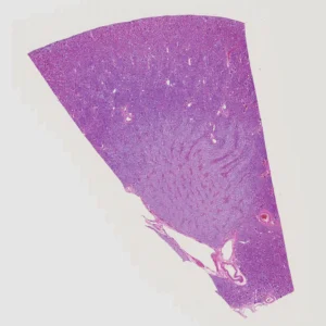 kidney section, H.E.