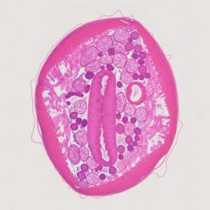 male Ascaris lumbricoides or Roundworm, 7 µm sec.