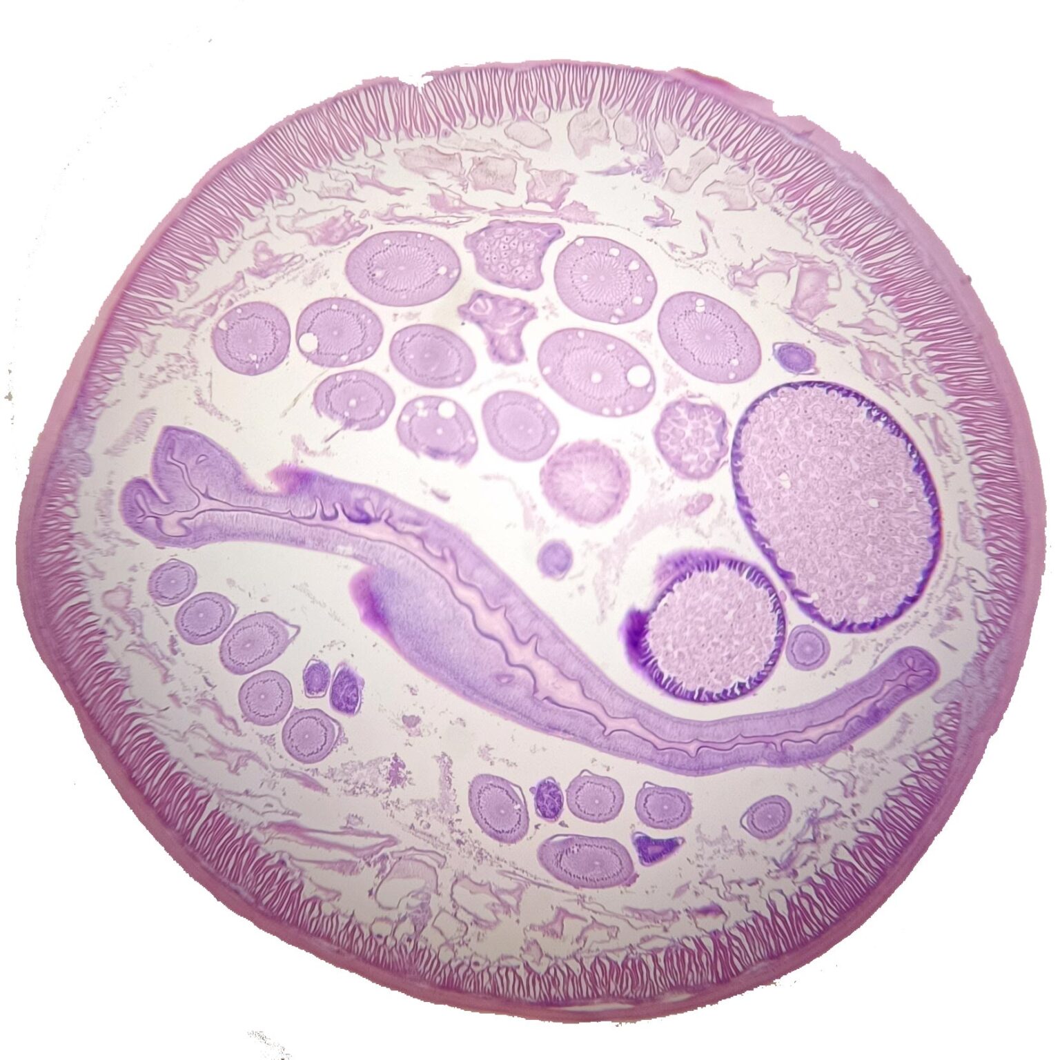 1pc female Ascaris lumbricoides or Roundworm, 7 µm sec., H&E Stain ...