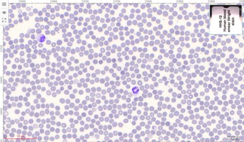 human blood smear, Wright's stain