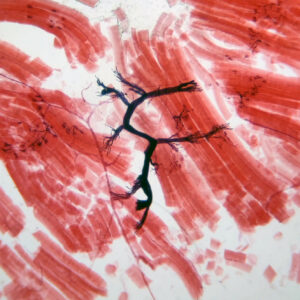 Skeletal muscle squash preparation special stained Motor end plate