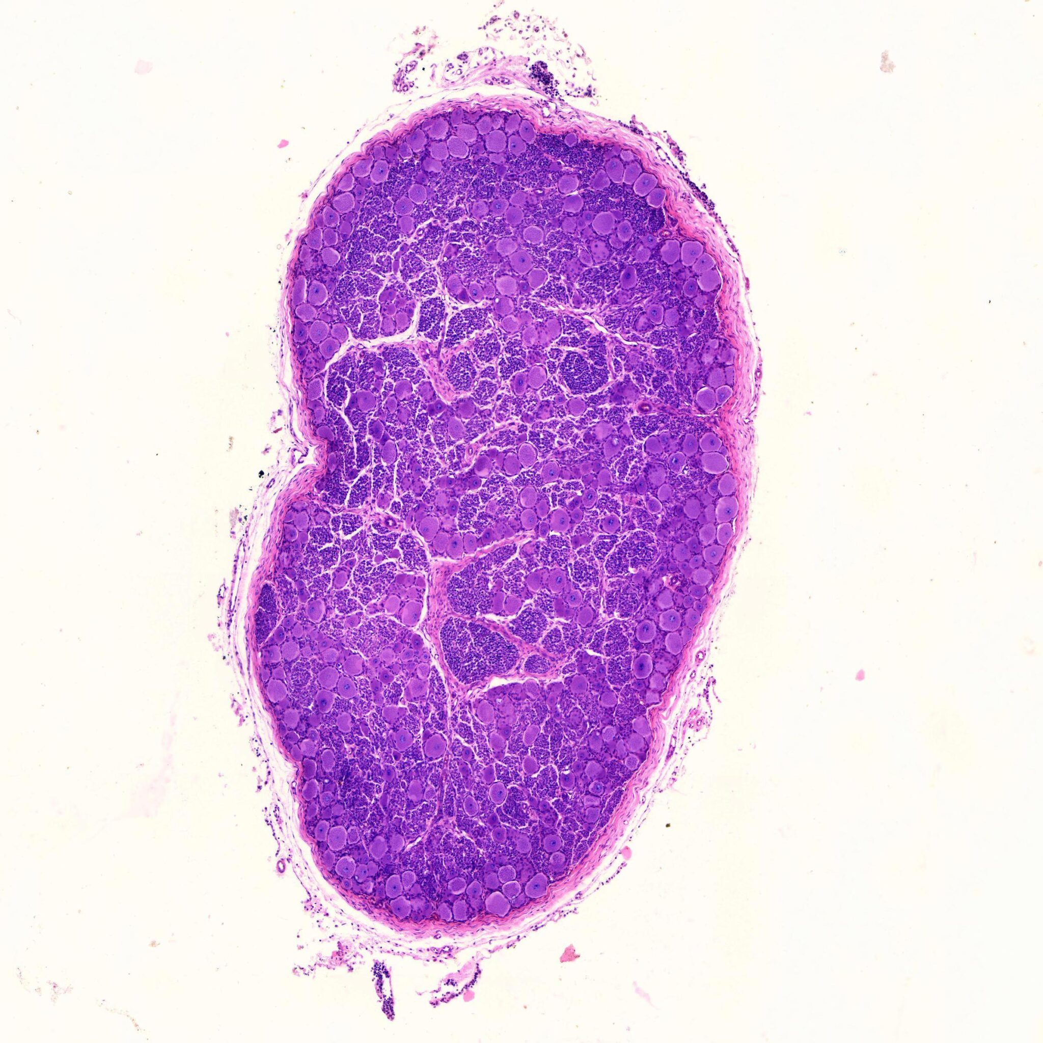 1pcs Dorsal Root Ganglion Cross Section, Spinal Ganglion, Human, H.E ...