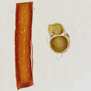 Nerve bundle l.s. and c.s. one same slide