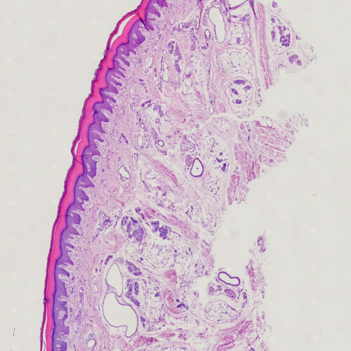 Tactile corpuscles or Meissner's corpuscles