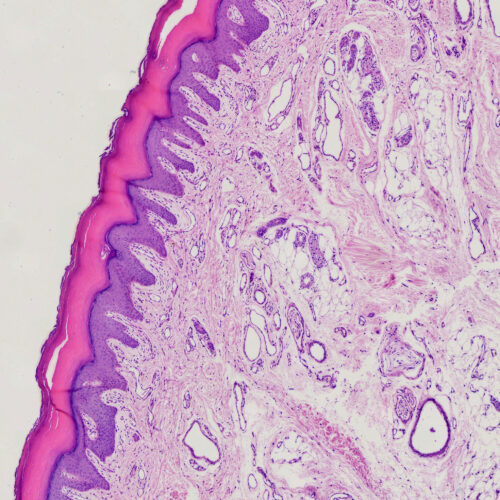 Tactile corpuscles or Meissner's corpuscles, section of human fingertip skin, H.E. Stained