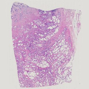 young man prostate gland