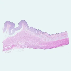 Cardia of stomach section